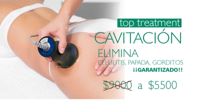 Cavitaci&oacute;n.