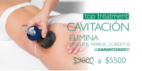 Cavitación.